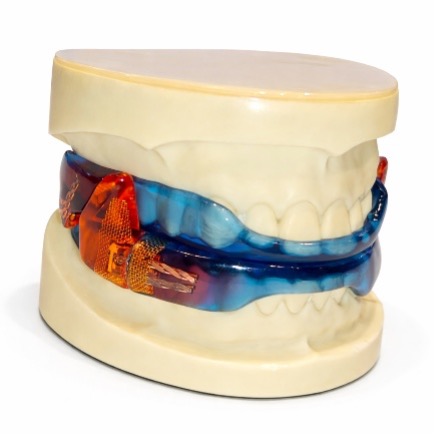 sportbitje tandzorg weesp